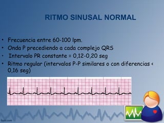 RITMO SINUSAL NORMAL
• Frecuencia entre 60-100 lpm.
• Onda P precediendo a cada complejo QRS
• Intervalo PR constante = 0,12-0,20 seg
• Ritmo regular (intervalos P-P similares o con diferencias <
0,16 seg)
 