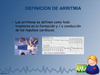 DEFINICION DE ARRITMIA
• Las arritmias se definen como todo
trastorno en la formación y / o conducción
de los impulsos cardíacos.
 