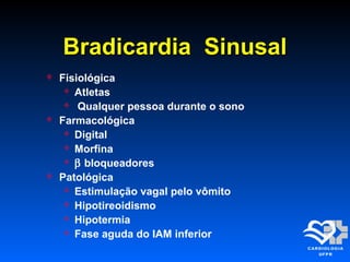 Bradicardia SinusalBradicardia Sinusal
 Fisiológica
 Atletas
 Qualquer pessoa durante o sono
 Farmacológica
 Digital
 Morfina
 β bloqueadores
 Patológica
 Estimulação vagal pelo vômito
 Hipotireoidismo
 Hipotermia
 Fase aguda do IAM inferior
 