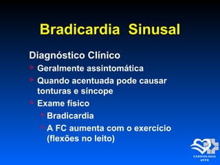 Bradicardia SinusalBradicardia Sinusal
Diagnóstico Clínico
 Geralmente assintomática
 Quando acentuada pode causar
tonturas e síncope
 Exame físico
 Bradicardia
 A FC aumenta com o exercício
(flexões no leito)
 