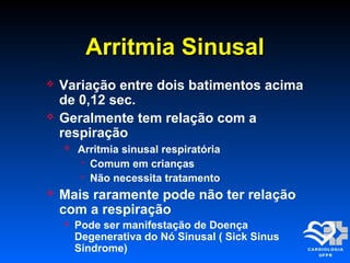 Arritmia SinusalArritmia Sinusal
 Variação entre dois batimentos acima
de 0,12 sec.
 Geralmente tem relação com a
respiração
 Arritmia sinusal respiratória
 Comum em crianças
 Não necessita tratamento
 Mais raramente pode não ter relação
com a respiração
 Pode ser manifestação de Doença
Degenerativa do Nó Sinusal ( Sick Sinus
Sindrome)
 