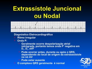Extrassístole JuncionalExtrassístole Juncional
ou Nodalou Nodal
Diagnóstico Eletrocardiográfico
 Ritmo irregular
 Onda P:
 Geralmente ocorre despolarização atrial
retrógrada, portanto temos onda P’ negativa em
D2 , D3 , aVF
 Pode ocorrer antes, durante ou após o QRS,
dependendo do local de origem da extrasssístole
no nó AV
 Pode estar ausente
 O complexo QRS geralmente é normal
 