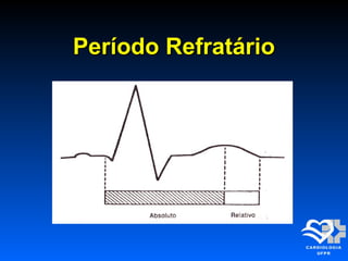 Período RefratárioPeríodo Refratário
 
