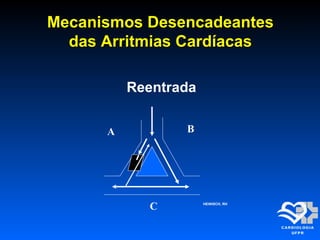 Mecanismos DesencadeantesMecanismos Desencadeantes
das Arritmias Cardíacasdas Arritmias Cardíacas
Reentrada
A B
C HEINISCH, RH
 