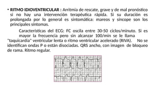 Ritmo Riva ARRITMIAS CARDÍACAS CONCEPTO Y TIPOS DE ARRITMIAS | PPTX