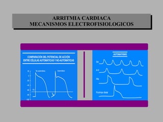 ARRITMIA CARDIACA MECANISMOS ELECTROFISIOLOGICOS 