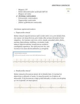 Ritmo Riva Arritmias cardiacas | PDF