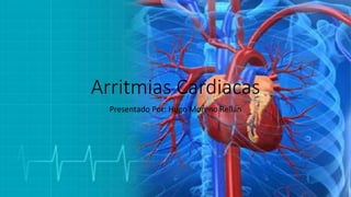 Arritmias Cardiacas
Presentado Por: Hugo Moreno Rellán
 