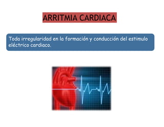 ARRITMIA CARDIACA
Toda irregularidad en la formación y conducción del estimulo
eléctrico cardiaco.
 