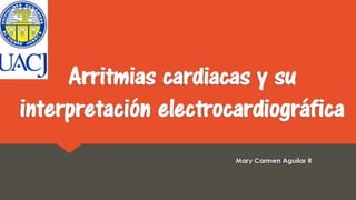 Arritmias cardiacas y su
interpretación
electrocardiográfica
Mary Carmen Aguilar R
 