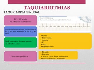 TAQUIARRITMIAS
TAQUICARDIA SINUSAL
 