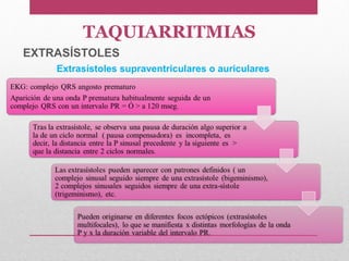 TAQUIARRITMIAS
EXTRASÍSTOLES
Extrasístoles supraventriculares o auriculares
 