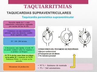 TAQUICARDIAS SUPRAVENTRICULARES
Taquicardia paroxística supraventricular
TAQUIARRITMIAS
 