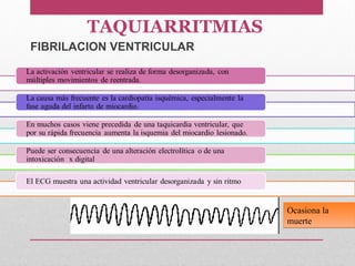 Ocasiona la
muerte
Ocasiona la
muerte
FIBRILACION VENTRICULAR
TAQUIARRITMIAS
 