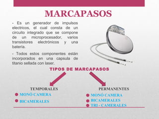 MARCAPASOS
- Es un generador de impulsos
electricos, el cual consta de un
circuito integrado que se compone
de un microprocesador, varios
transistores electrónicos y una
batería.
- Todos estos componentes están
incorporados en una capsula de
titanio sellada con laser.
TIPOS DE MARCAPASOS
TEMPORALES PERMANENTES
MONÓ CAMERA
BICAMERALES
MONÓ CAMERA
BICAMERALES
TRI - CAMERALES
 