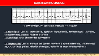 Is The Rto R Regular In A Flutter Comprehensive Overview of Cardiac Arrhythmias and Electrophysiology | PPTX