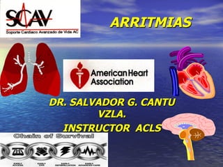 ARRITMIAS
DR. SALVADOR G. CANTU
VZLA.
INSTRUCTOR ACLS
 