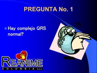  Hay complejo QRS
normal?
PREGUNTA No. 1
 