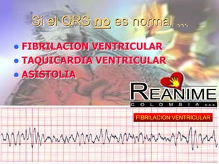 Si el QRS no es normal ...
 FIBRILACION VENTRICULAR
 TAQUICARDIA VENTRICULAR
 ASISTOLIA
FIBRILACION VENTRICULAR
 