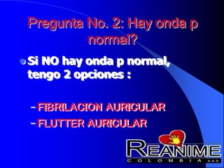 Pregunta No. 2: Hay onda p
normal?
 Si NO hay onda p normal,
tengo 2 opciones :
– FIBRILACION AURICULAR
– FLUTTER AURICULAR
 