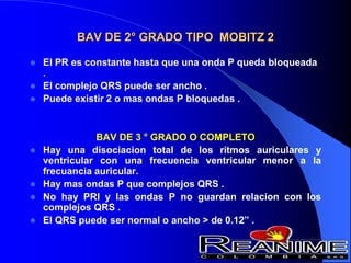 BAV DE 2° GRADO TIPO MOBITZ 2
 El PR es constante hasta que una onda P queda bloqueada
.
 El complejo QRS puede ser ancho .
 Puede existir 2 o mas ondas P bloquedas .
BAV DE 3 ° GRADO O COMPLETO
 Hay una disociacion total de los ritmos auriculares y
ventricular con una frecuencia ventricular menor a la
frecuancia auricular.
 Hay mas ondas P que complejos QRS .
 No hay PRI y las ondas P no guardan relacion con los
complejos QRS .
 El QRS puede ser normal o ancho > de 0.12” .
 