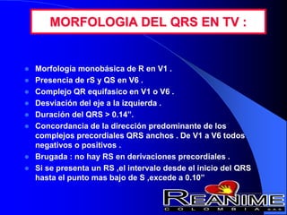 MORFOLOGIA DEL QRS EN TV :
 Morfología monobásica de R en V1 .
 Presencia de rS y QS en V6 .
 Complejo QR equifasico en V1 o V6 .
 Desviación del eje a la izquierda .
 Duración del QRS > 0.14”.
 Concordancia de la dirección predominante de los
complejos precordiales QRS anchos . De V1 a V6 todos
negativos o positivos .
 Brugada : no hay RS en derivaciones precordiales .
 Si se presenta un RS ,el intervalo desde el inicio del QRS
hasta el punto mas bajo de S ,excede a 0.10”
 