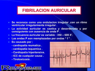 FIBRILACION AURICULAR
 Se reconoce como una ondulacion irregular ,con un ritmo
ventricular irregularmente irregular .
 La actividad auricular es caotica y desordenada y por
consiguiente con ausencia de onda P .
 La frecuencia auricular es variable : 350 – 600 X’.
 Las ondas P son reemplazadas por ondas “ f ” .
 Es causado por :
- cardiopatia reumatica .
- cardiopatia isquemica .
- Cardiopatia hipertensiva.
- ICC de cualquier causa .
- Tirotoxicosis .
 