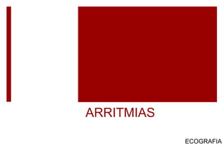 ARRITMIAS
ECOGRAFIA
 