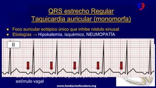 www.fundacionfavaloro.org
● Foco auricular ectópico único que inhibe nódulo sinusal
● Etiologías → Hipokalemia, isquémico, NEUMOPATÍA
● Características:
QRS estrecho Regular
Taquicardia auricular (monomorfa)
○ FR 150-200 REGULAR (Inicio y fin gradual)
○ Onda P:
■ Distinta a la sinusal
■ Igual entre ellas → negativas en cara inferior (si
se originan en zonas bajas).
○ Se diferencia de TS o TPS porque persiste ante
estímulo vagal
 