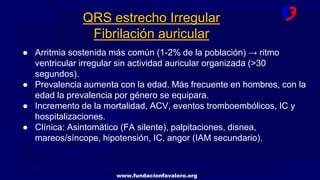 www.fundacionfavaloro.org
QRS estrecho Irregular
Fibrilación auricular
● Arritmia sostenida más común (1-2% de la población) → ritmo
ventricular irregular sin actividad auricular organizada (>30
segundos).
● Prevalencia aumenta con la edad. Más frecuente en hombres, con la
edad la prevalencia por género se equipara.
● Incremento de la mortalidad, ACV, eventos tromboembólicos, IC y
hospitalizaciones.
● Clínica: Asintomático (FA silente), palpitaciones, disnea,
mareos/síncope, hipotensión, IC, angor (IAM secundario).
 
