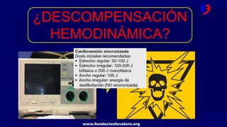 www.fundacionfavaloro.org
¿DESCOMPENSACIÓN
HEMODINÁMICA?
 