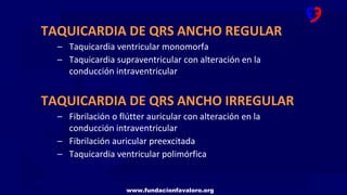www.fundacionfavaloro.org
TAQUICARDIA DE QRS ANCHO REGULAR
– Taquicardia ventricular monomorfa
– Taquicardia supraventricular con alteración en la
conducción intraventricular
TAQUICARDIA DE QRS ANCHO IRREGULAR
– Fibrilación o flútter auricular con alteración en la
conducción intraventricular
– Fibrilación auricular preexcitada
– Taquicardia ventricular polimórfica
 
