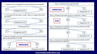 www.fundacionfavaloro.org
BRUGADA
VERECKEI
AvR
 