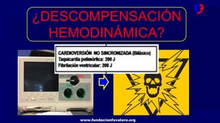 www.fundacionfavaloro.org
¿DESCOMPENSACIÓN
HEMODINÁMICA?
 