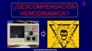www.fundacionfavaloro.org
¿DESCOMPENSACIÓN
HEMODINÁMICA?
 
