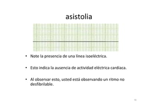 16
asistolia
• Note la presencia de una línea isoeléctrica.
• Esto indica la ausencia de actividad eléctrica cardiaca.
• Al observar esto, usted está observando un ritmo no
desfibrilable.
 