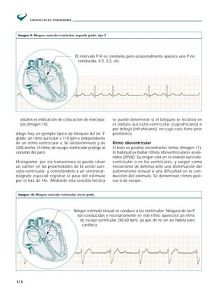 Ritmo Riva Arritmias (muy bueno) | PDF
