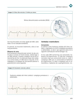 Ritmo Riva Arritmias (muy bueno) | PDF
