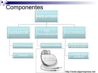Componentes

http://www.algarvepress.net

 