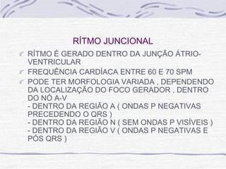 RÍTMO JUNCIONAL
RÍTMO É GERADO DENTRO DA JUNÇÃO ÁTRIO-
VENTRICULAR
FREQUÊNCIA CARDÍACA ENTRE 60 E 70 SPM
PODE TER MORFOLOGIA VARIADA , DEPENDENDO
DA LOCALIZAÇÃO DO FOCO GERADOR , DENTRO
DO NÓ A-V
- DENTRO DA REGIÃO A ( ONDAS P NEGATIVAS
PRECEDENDO O QRS )
- DENTRO DA REGIÃO N ( SEM ONDAS P VISÍVEIS )
- DENTRO DA REGIÃO V ( ONDAS P NEGATIVAS E
PÓS QRS )
 