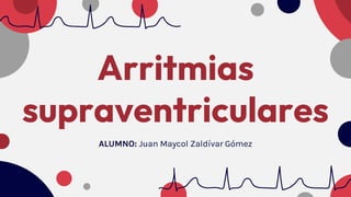 Arritmias
supraventriculares
ALUMNO: Juan Maycol Zaldívar Gómez
 