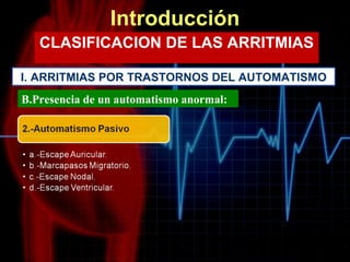 Introducción ,[object Object],I. ARRITMIAS POR TRASTORNOS DEL AUTOMATISMO B.Presencia de un automatismo anormal: 