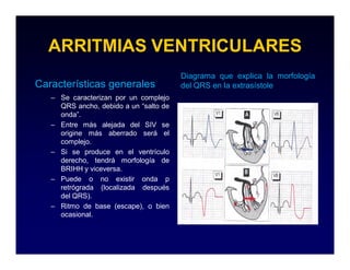 ARRITMIAS VENTRICULARES
                                        Diagrama que explica la morfología
Características generales               del QRS en la extrasístole
   – Se caracterizan por un complejo
     QRS ancho, debido a un “salto de
     onda”.
   – Entre más alejada del SIV se
     origine más aberrado será el
     complejo.
   – Si se produce en el ventrículo
     derecho, tendrá morfología de
     BRIHH y viceversa.
   – Puede o no existir onda p
     retrógrada (localizada después
     del QRS).
   – Ritmo de base (escape), o bien
     ocasional.
 