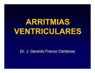 ARRITMIAS
VENTRICULARES

 Dr. J. Gerardo Franco Cárdenas
 