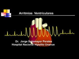 Arritmias Ventriculares
Dr. Jorge Sotomayor Perales
Hospital Nacional Hipolito Unanue
 