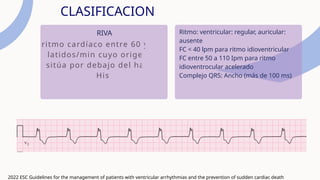 Ritmo Riva Arritmias ventriculares CON NOTAS.ppt medicx | PPTX