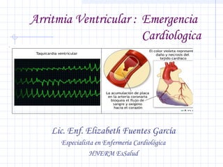 Arritmia Ventricular : Emergencia 
Cardiologica
.

.

Lic. Enf. Elizabeth Fuentes García
Especialista en Enfermería Cardiológica
HNERM EsSalud

 