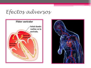 Efectos adversos
 