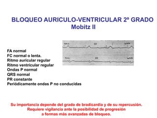 BLOQUEO AURICULO-VENTRICULAR 2º GRADO 
Mobitz II 
FA normal 
FC normal o lenta. 
Ritmo auricular regular 
Ritmo ventricular regular 
Ondas P normal 
QRS normal 
PR constante 
Periódicamente ondas P no conducidas 
Su importancia depende del grado de bradicardia y de su repercusión. 
Requiere vigilancia ante la posibilidad de progresión 
a formas más avanzadas de bloqueo. 
 