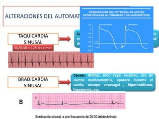 ALTERACIONES DEL AUTOMATISMO FISIOLÓGICO
Causas: Aumento de temperatura corporal,
estimulación de SNA, hipertiroidismo, toxicidad
del corazón por fármacos
TAQUICARDIA
SINUSAL
60/0.48 = 125 lat x min
BRADICARDIA
SINUSAL
Causas: Atletas, tono vagal excesivo, uso de
ciertos medicamentos, aparece durante el
sueño, síncope vasovagal , hipotiroidismo,
hipotermia, etc.
 